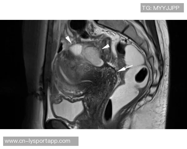 约维奇重摔受伤退场X光检查结果无异常明日将进行MRI检查评估伤情